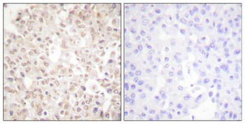 Akt Polyclonal Antibody