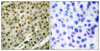 Akt Polyclonal Antibody