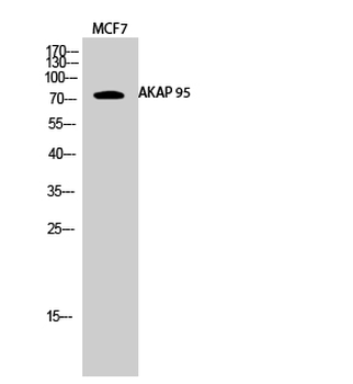AKAP 95 Polyclonal Antibody