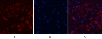 Actin β Polyclonal Antibody