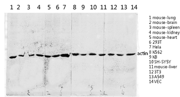 Actin Polyclonal Antibody