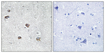 ACSL6 Polyclonal Antibody