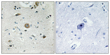 ACOT4 Polyclonal Antibody
