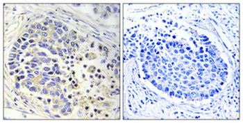 ACOT2 Polyclonal Antibody