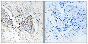 ACOT1 Polyclonal Antibody
