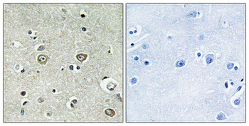 ABHD8 Polyclonal Antibody