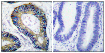 4E-BP1 Polyclonal Antibody