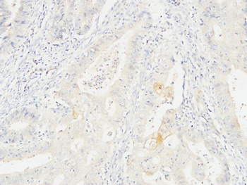 14-3-3 σ Polyclonal Antibody