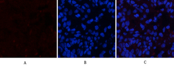 ERK 1/2 (phospho Thr202/Y204) Polyclonal Antibody