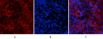 ERK 1/2 (phospho Thr202/Y204) Polyclonal Antibody