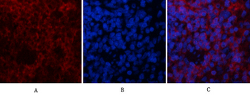 ERK 1/2 (phospho Thr202/Y204) Polyclonal Antibody