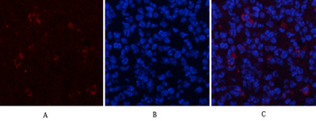 ERK 1/2 (phospho Thr202/Y204) Polyclonal Antibody