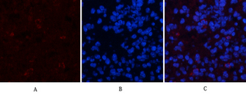 ERK 1/2 (phospho Thr202/Y204) Polyclonal Antibody