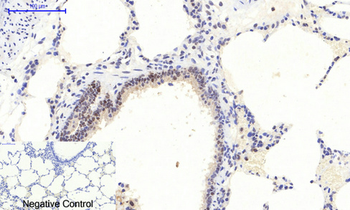 ERK 1/2 (phospho Thr202/Y204) Polyclonal Antibody
