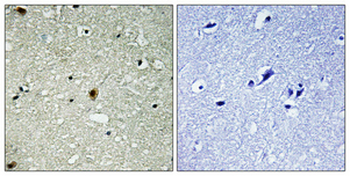 HIRA (phospho Thr555) Polyclonal Antibody