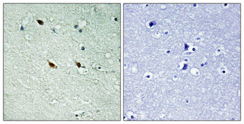NIFK (phospho Thr234) Polyclonal Antibody