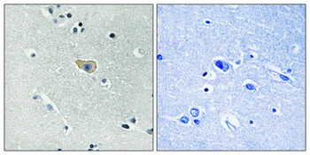 NMDAζ1 (phospho Ser890) Polyclonal Antibody