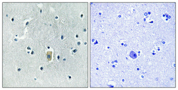 Bim (phospho Ser59) Polyclonal Antibody