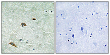 TTK (phospho Thr676) Polyclonal Antibody