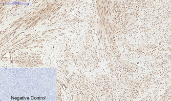 PERK (phospho Thr981) Polyclonal Antibody