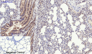 PERK (phospho Thr981) Polyclonal Antibody