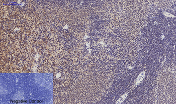 PERK (phospho Thr981) Polyclonal Antibody