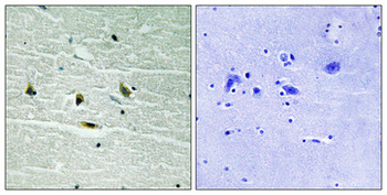 JAK2 (phospho Tyr119) Polyclonal Antibody