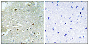 HAND1 (phospho Ser98) Polyclonal Antibody