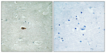 ErbB-3 (phospho Tyr1328) Polyclonal Antibody