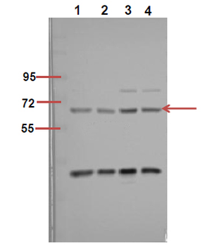p70 S6 kinase α (phospho Ser418) Polyclonal Antibody