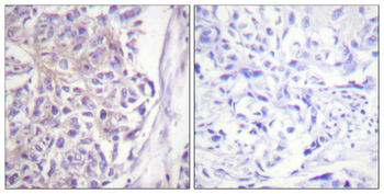 Cot (phospho Thr290) Polyclonal Antibody