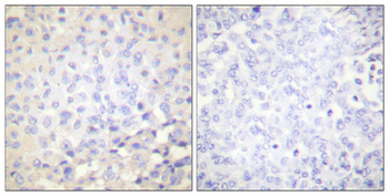 IκB-ε (phospho Ser22) Polyclonal Antibody