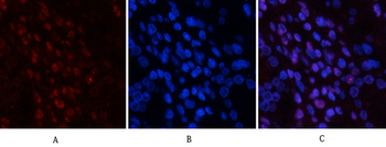JNK1/2/3 (phospho Tyr185) Polyclonal Antibody
