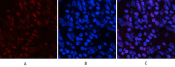 JNK1/2/3 (phospho Tyr185) Polyclonal Antibody
