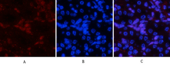 JNK1/2/3 (phospho Tyr185) Polyclonal Antibody