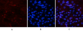 JNK1/2/3 (phospho Tyr185) Polyclonal Antibody