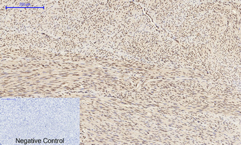 JNK1/2/3 (phospho Tyr185) Polyclonal Antibody