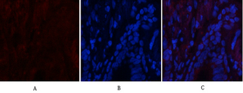 CaMKIIβ/γ/δ (phospho Thr287) Polyclonal Antibody