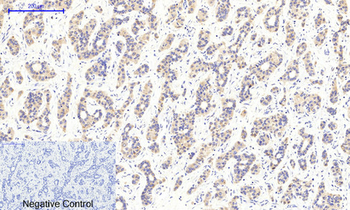 CaMKIIβ/γ/δ (phospho Thr287) Polyclonal Antibody
