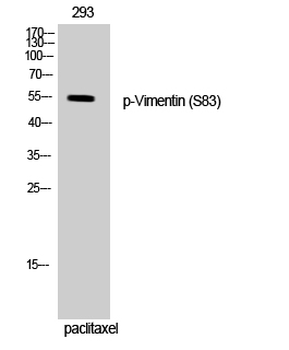 Vimentin (phospho Ser83) Polyclonal Antibody