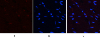 PI 3-kinase p85α (phospho Tyr607) Polyclonal Antibody