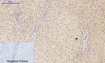 PI 3-kinase p85α (phospho Tyr607) Polyclonal Antibody