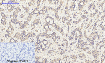 PI 3-kinase p85α (phospho Tyr607) Polyclonal Antibody