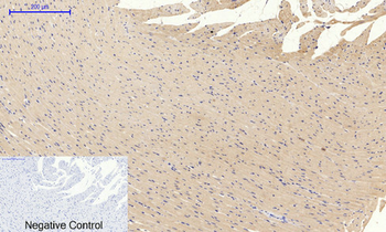 PI 3-kinase p85α (phospho Tyr607) Polyclonal Antibody
