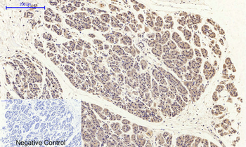 FAK (phospho Tyr397) Polyclonal Antibody