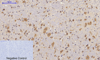FAK (phospho Tyr397) Polyclonal Antibody