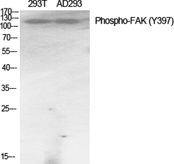 FAK (phospho Tyr397) Polyclonal Antibody