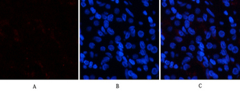 p38 (phospho Tyr323) Polyclonal Antibody