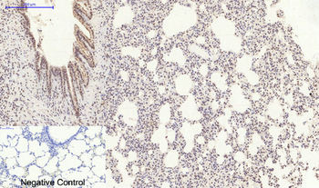 p38 (phospho Tyr323) Polyclonal Antibody