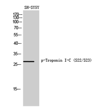 Troponin I-C (phospho Ser22/S23) Polyclonal Antibody